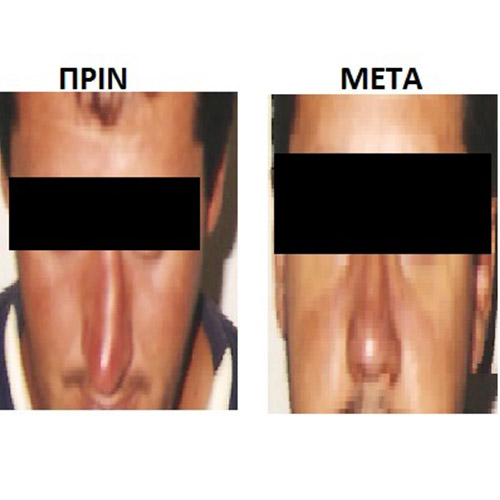 Επέμβαση 10