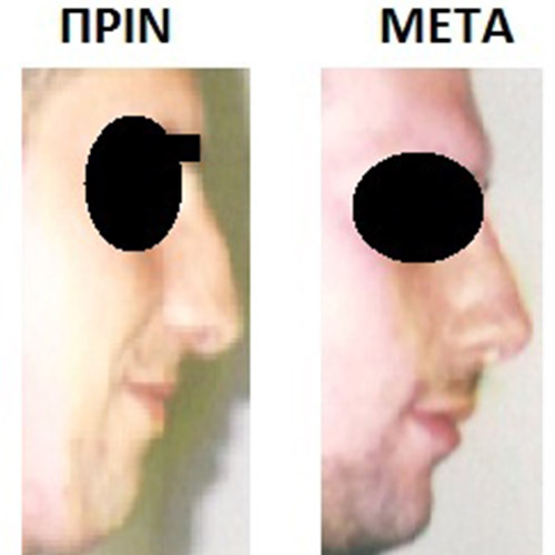 Επέμβαση 19